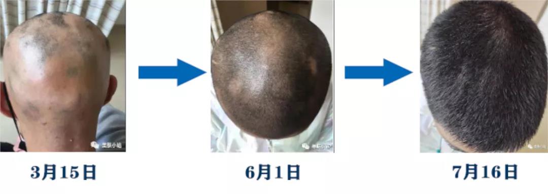 6374148249307226571560241.jpg